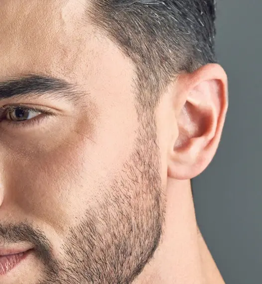 Male Ears Laser Treatment