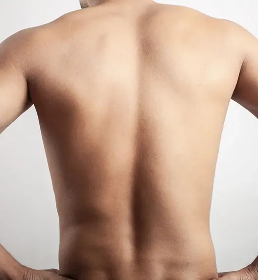 Male Full Back Laser Treatment Model