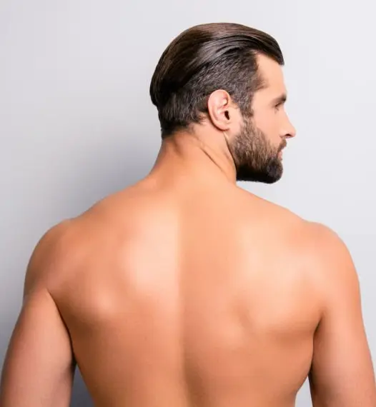 Male Half Back Laser Treatment Model
