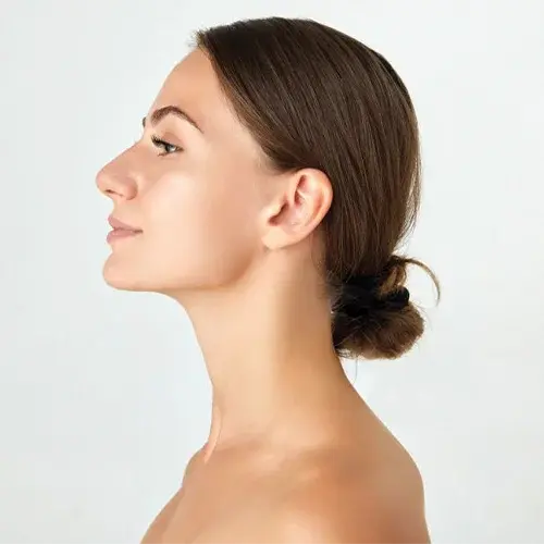 Female Side Face Laser Treatment Model