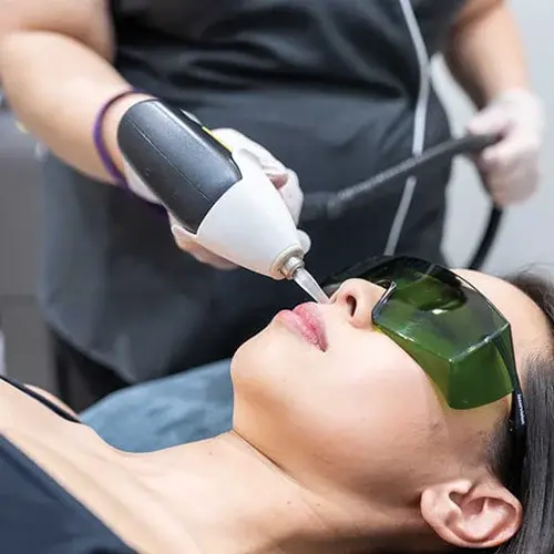 Female Nose Laser Treatment Model