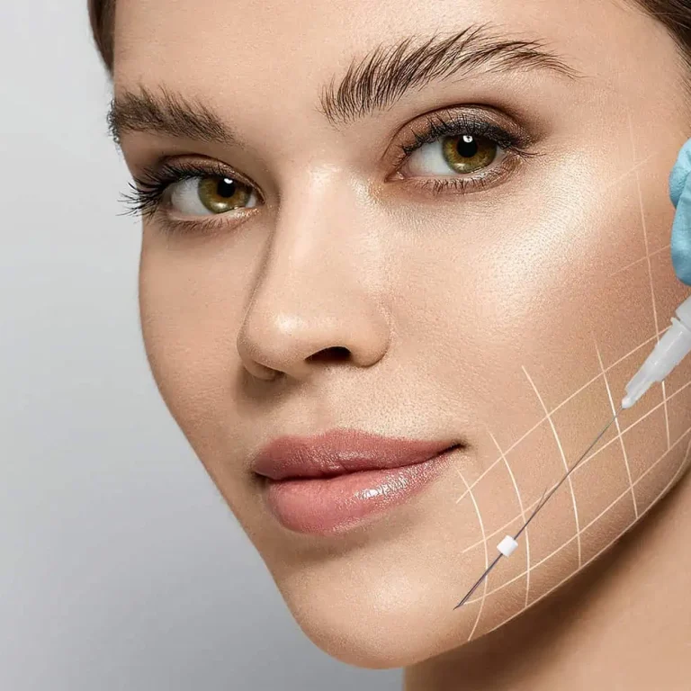 Jawline threads 1st picture