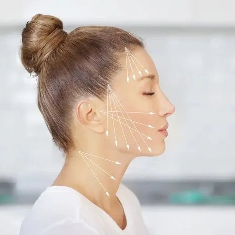 Neck threads 1st picture