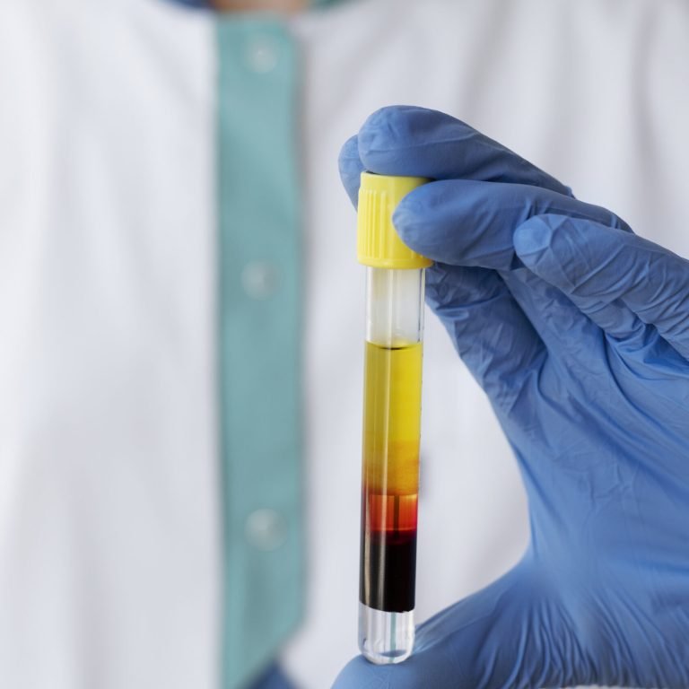 PRP face & hair in replacement of 2nd picture